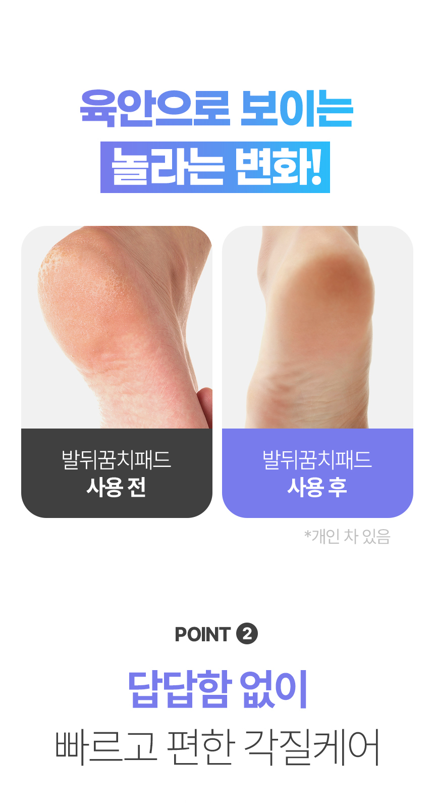 발 각질 제거 뒤꿈치 굳은살 풋케어 실리콘 양말 패드  (8).jpg